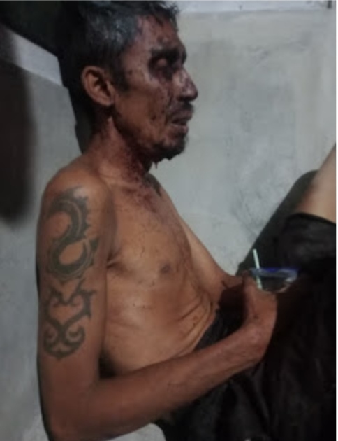 Di Duga Jadi Korban Penganiayaan Pria 50 Tahun Ditemukan Bersimbah Darah Di Tanjakan Bukit Desa Nowa, Jum'at 03Juli 2026.